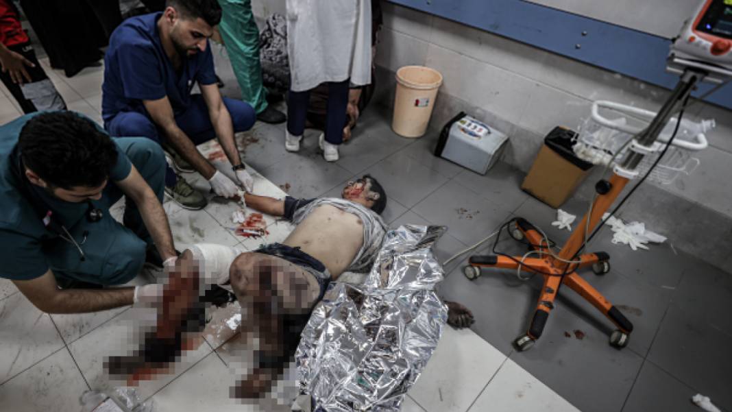 Gazze'de 'insanlık' ölüyor... Hastane mezarlığa döndü 4